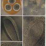 microclavatus